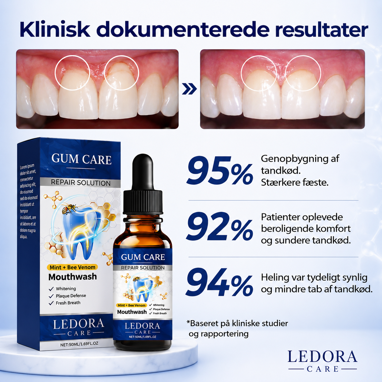 DentaFort™ – Stærkere Tænder & Sundere Tandkød